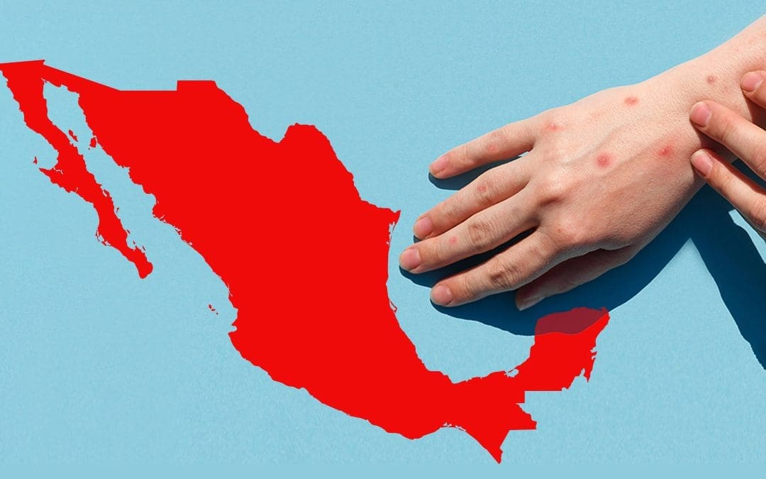 Brote de sarampión deja 21 muertos en México; Chihuahua, el estado más afectado