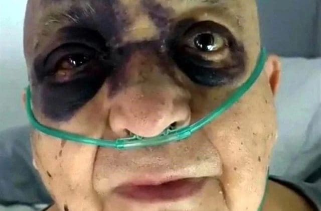 Luis de Alba aclara su estado de salud tras ser hospitalizado por accidente