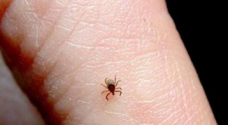 Rickettsiosis casi triplica los registros del año pasado: Salud 